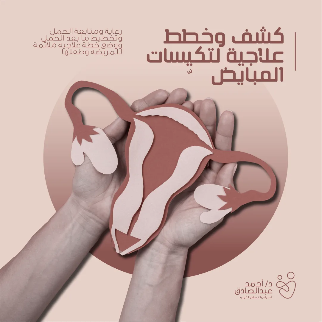 كشف وخطط علاجية لتكيسات المبايض — رحم من الورق بين يدين